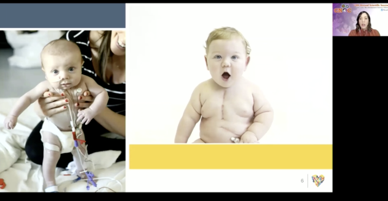 DrSamButler's tweet photo. Lauren Malik so eloquently representing the NPCQIC gross motor project. Supporting Gross Motor Developmental Outcomes Among Infants with Single-Ventricle Congenital Heart Disease Through Collaborative Quality Improvement https://t.co/nnQY4xe4Q9 #CNOC2021 https://t.co/aot1HylueU