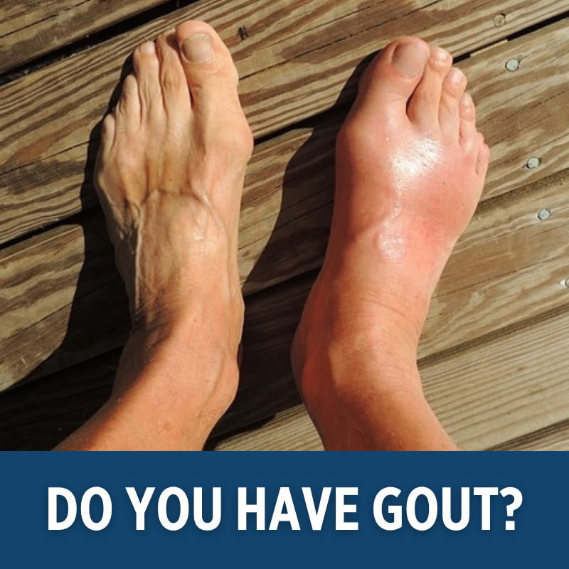 River_Podiatry's tweet photo. Our Dr. Jungwoo shared everything you need to know if you have gout. Click the link below to learn more. 

https://t.co/f8SbmbrJh1 https://t.co/fuc9mM4l64