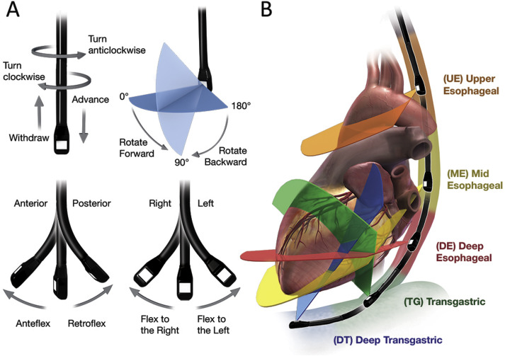 New TEE in Structural Heart Intervention Guideline Now Available Online: bit.ly/3qUfny3 Lead author @hahn_rt will present 2 webinars on this guideline Dec. 15 & 17. Save the date. Registration will open soon!