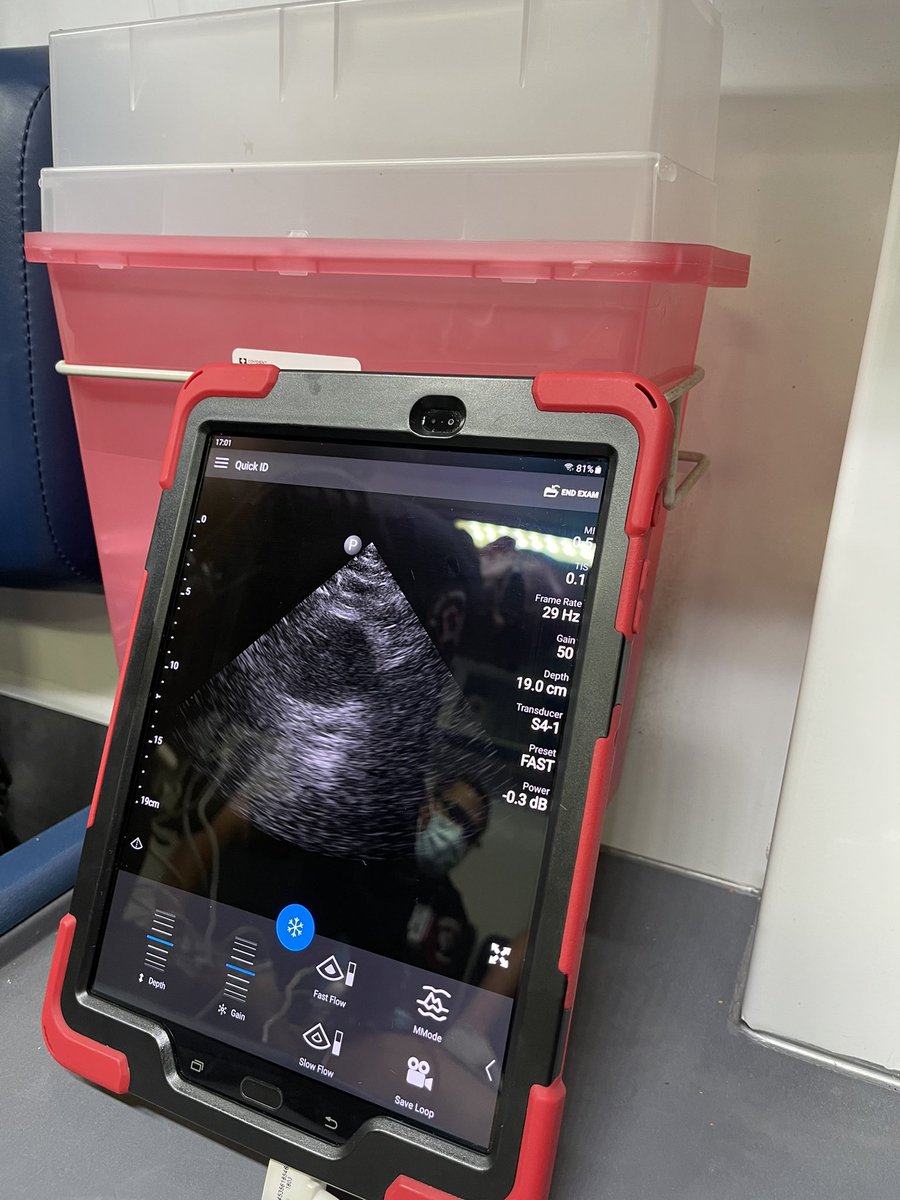Chivas_EMS_NP's tweet photo. Come join Dr. Ideen Zeinali and I on Tuesday as we talk about pre-hospital ultrasound. We’ll discuss training, implementation, quality improvement, and lessons learned. #POCUS #texasemsconference2021 #EMS #HCEC https://t.co/Hrscb2PK4h