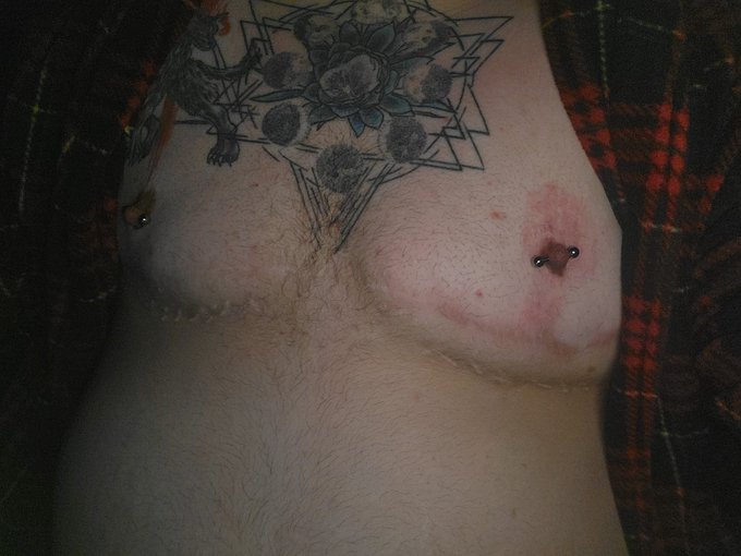 Older daddy was sucking on this tiddy like his last meal 🔥🥵 https://t.co/G4rEaE3ZKJ<a href="/tag/creampie"class="tags"><span>#creampie</span></a><a href="/tag/ftmslut"class="tags"><span>#ftmslut</span></a><a href="/tag/ftmbottom"class="tags"><span>#ftmbottom</span></a>