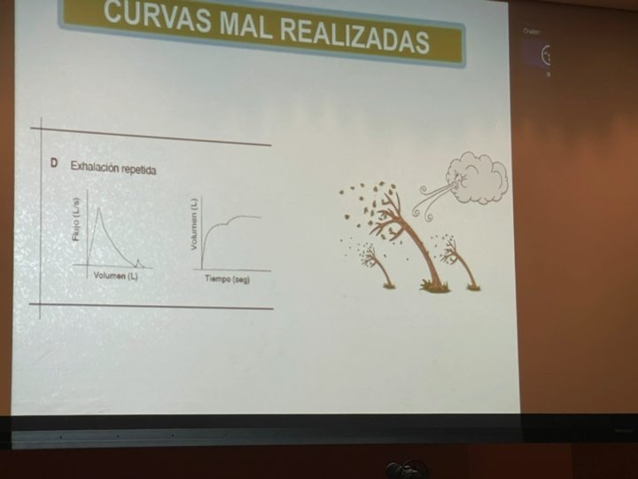 ibsemergen's tweet photo. Curvas de #espirometrias mal realizadas, desechar y no interpretar
#JornadasIB21

@SEMERGENap @SEMERGEN_MIR  
@RSemergen 
@Juan_PeiroM @Anasamez https://t.co/Y9XuOglbrg