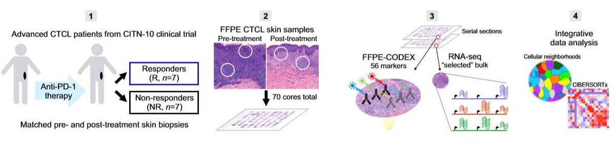 NatureComms's tweet photo. SpatialScore, a spatial biomarker of immune cell topography, predicts response to PD-1 blockade in cutaneous T cell lymphoma.
https://t.co/V7Q9M66mcx
#CancerResearch @natrescancer
@GarryPNolan @MagdaMatusiak @SizunJ https://t.co/ZPV7vex4y7