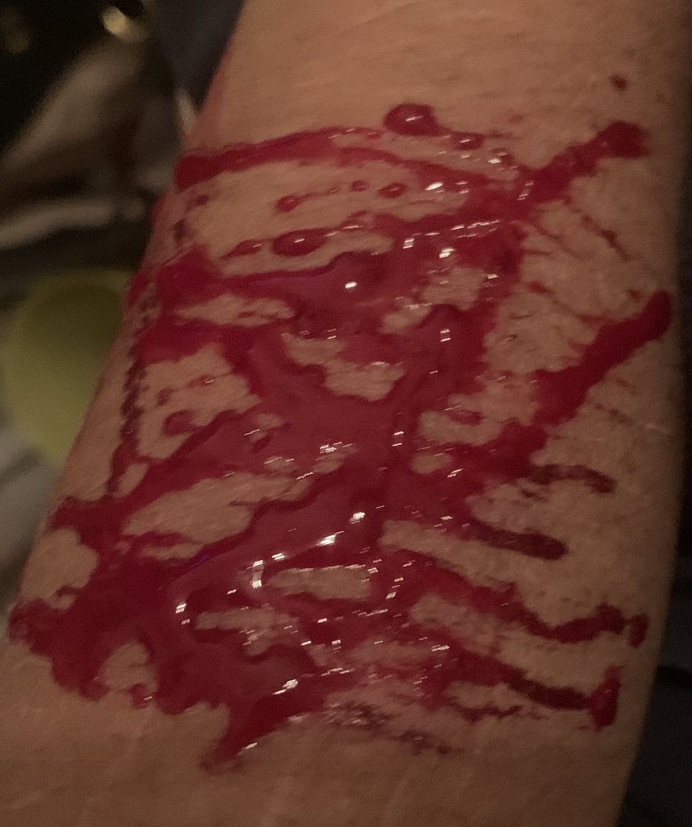 doodooheadass71's tweet photo. tw-cw// blood, sh
-
-
-
-
-
-
-
-
-
-
A#-

-a#
-
-
A#shwtwt barcodetwt yeettwt https://t.co/MA6LkrKnPQ