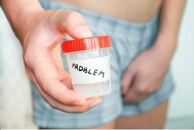 подписывать ли баночку с мочой. подписанные баночки для мочи. подписать баночку с анализами. баночка для посева мочи. банка для мочи.