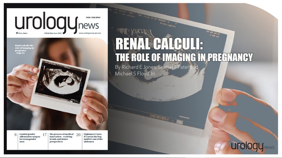 Nephrolithiasis is the most common cause of non-obstetric abdominal pain in pregnancy. In this feature for Urology News &gt; bit.ly/3prptpo the authors describe the role of imaging in pregnancy