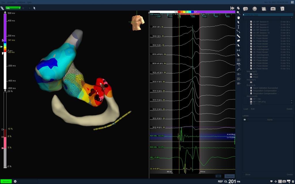 yagmr_aysel's tweet photo. Girls power @vebedu #abbottcardiovascular #EPeeps https://t.co/6tBXUk3RzE