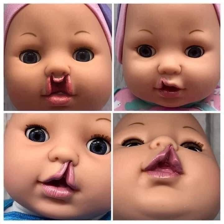 RaceAware's tweet photo. Inclusive Dolls

Since her daughter didn't identify with any of her toys because of her hearing impairment, Clare Tawell 39-year-old British mother began making unique toys... for her daughter and then for other children. 😍🙌 https://t.co/Aq9mR4cf3X
