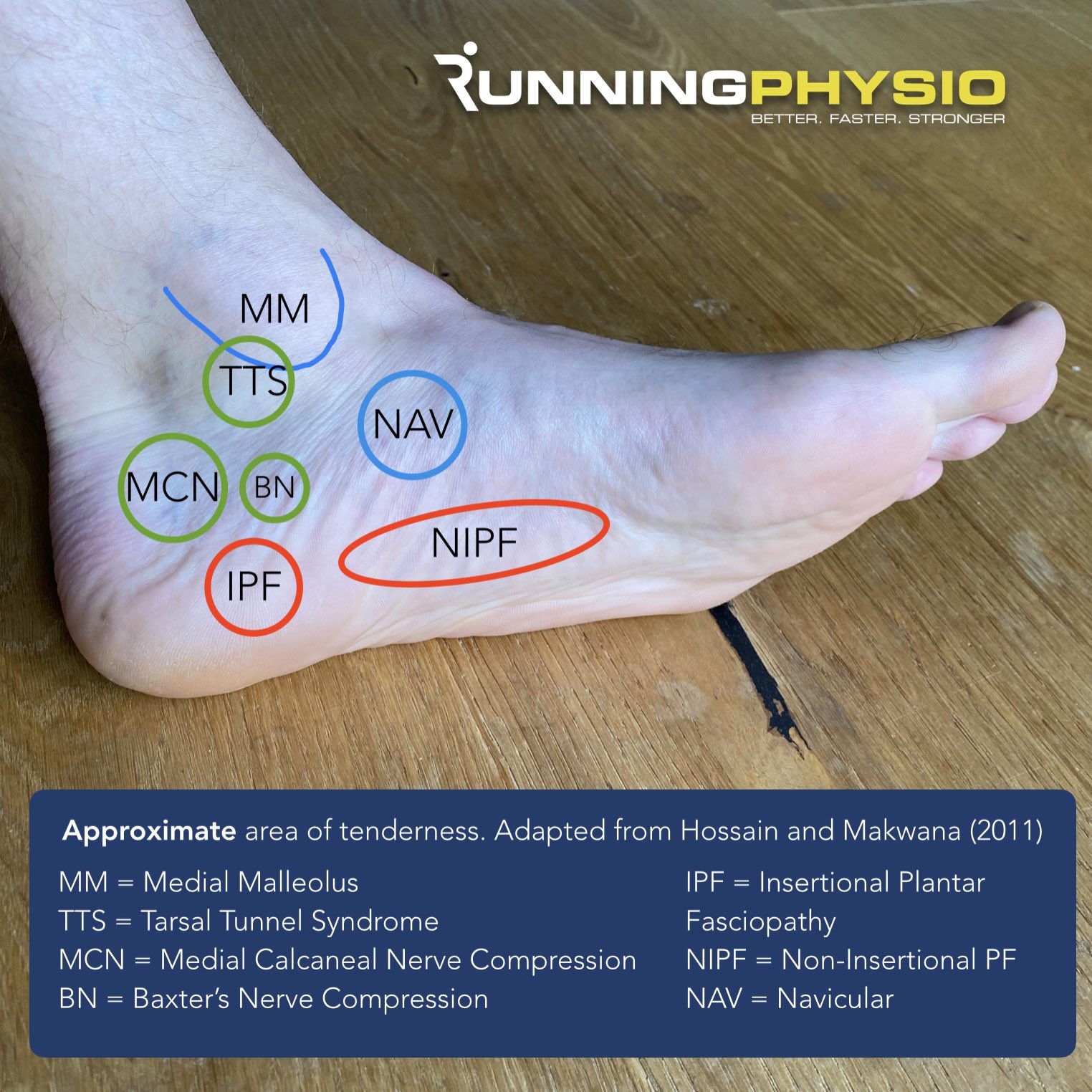 Lateral heel pain running sale