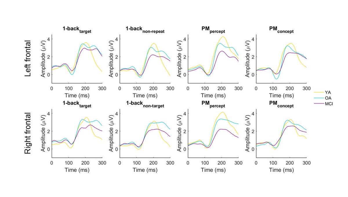 ClinicalNeuroph's tweet photo. [Prospective memory and working memory] Crook-Rumsey et al.: This is the first study to document the role of reorienting negativity in prospective memory (PM) and to investigate neurophysiological mechanisms underpinning PM in mild cognitive impairment.
https://t.co/YKOhpYmkBV https://t.co/vxOgcDEfSE