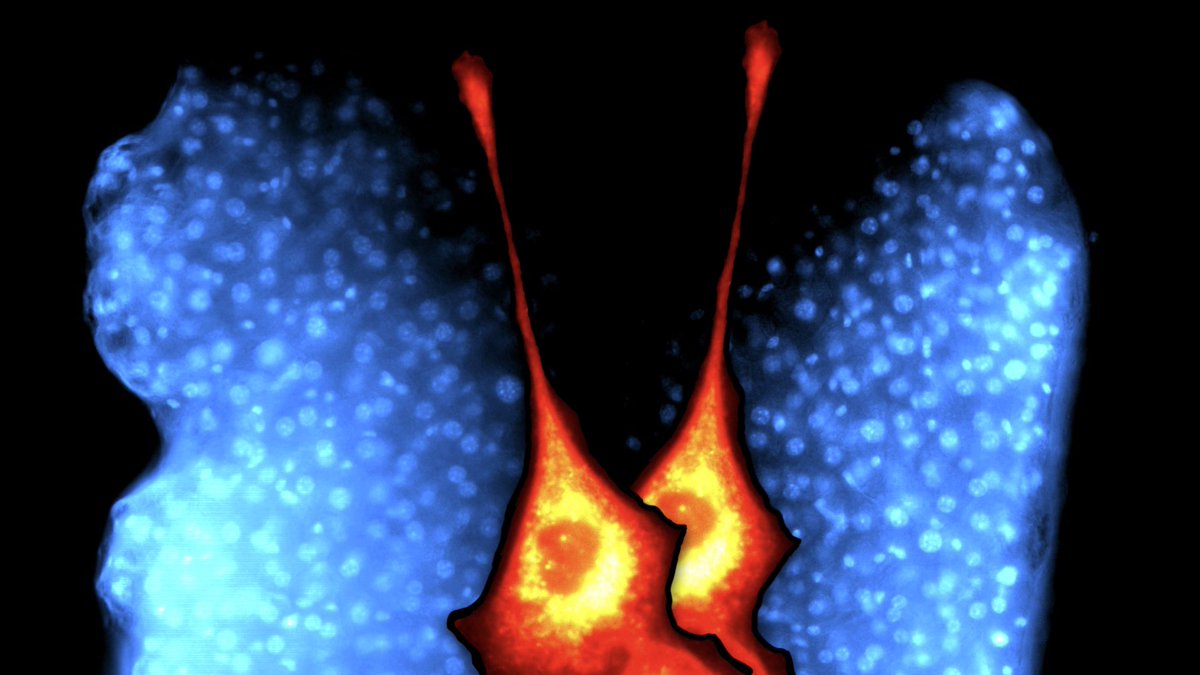 Elias Arturo Halabi Rosillo (@elias_halabi_) on Twitter photo Happy to announce that “The Hope of Gliomorphosis” won the Science as Art MGRI Image Award! #Butterflyglioma . Made from stained dead tissue and live glioblastoma cells in the <a href="/WeisslederLab/">Weissleder</a> . #fluorescencefriday Happy to announce that “The Hope of Gliomorphosis” won the Science as Art MGRI Image Award! #Butterflyglioma . Made from stained dead tissue and live glioblastoma cells in the <a href="/WeisslederLab/">Weissleder</a> . #fluorescencefriday