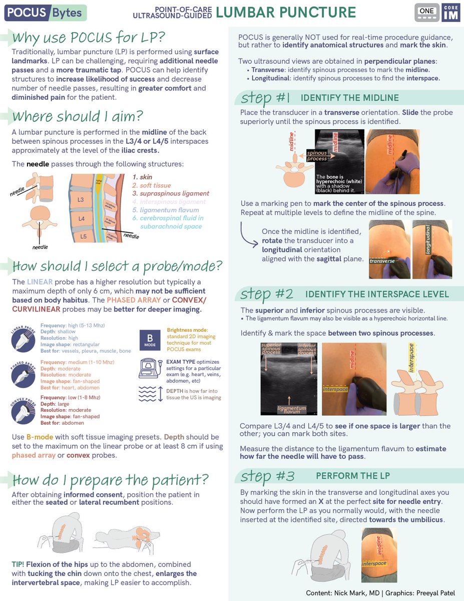 COREIMpodcast's tweet photo. Happy Friday #MedTwitter. This week we had a whole #Tweetorial series on #POCUS guided LP's and today we're posting our one pager. 

Shout-out to the author @nickmmark and graphics by @Preeyal_P ! https://t.co/CMWJgVTDVu