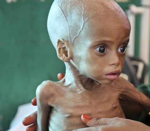 zoomabus's tweet image. ENIGME DU JOUR
Ils veulent injecter la terre entière mais n'ont jamais rien fait pour éradiquer la famine...
POURQUOI ?
