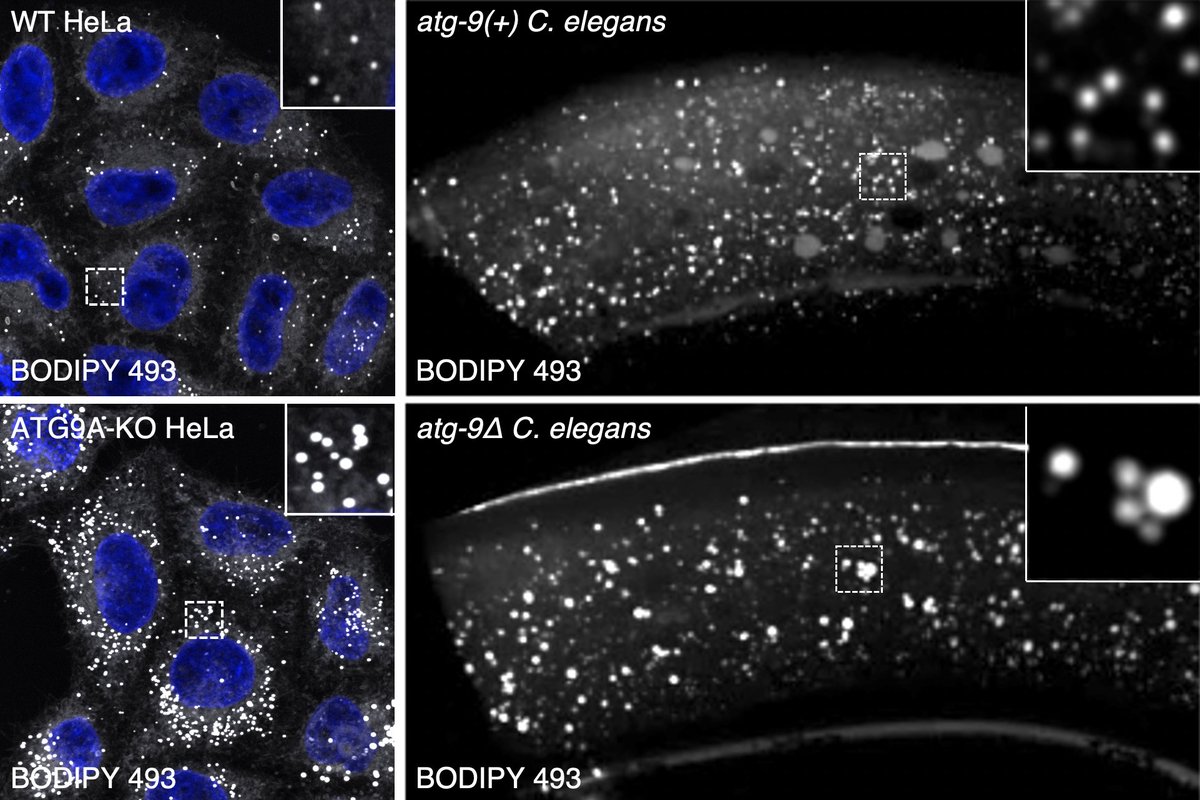 BonifacinoJuan's tweet photo. KO of the #phospholipid scramblase ATG9A in human cells enlarges the #lipiddroplet compartment and impairs fatty acid import and #betaoxidation in #mitochondria. Experiments by @bai_xfei and Andy Golden show similar #lipiddroplet enlargement in ATG-9 KO #Celegans hypodermal cells https://t.co/Vo2UCAfsI4