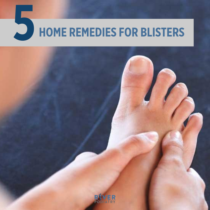 River_Podiatry's tweet photo. Blisters can happen often but they are easy to fix and heal. Click the link below for 5 home remedies to help you with your blisters. 

https://t.co/KrUdbLLtcw https://t.co/ygHb0SyySx
