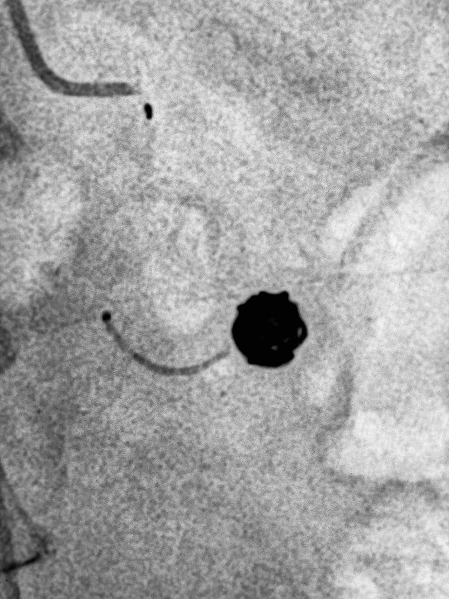 Alexandria CVIR tweet media