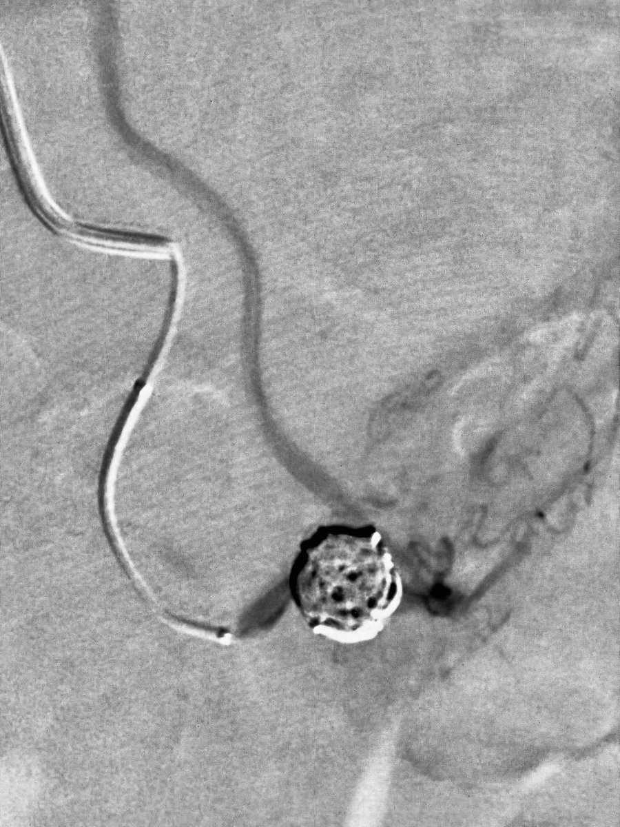 Alexandria CVIR tweet media