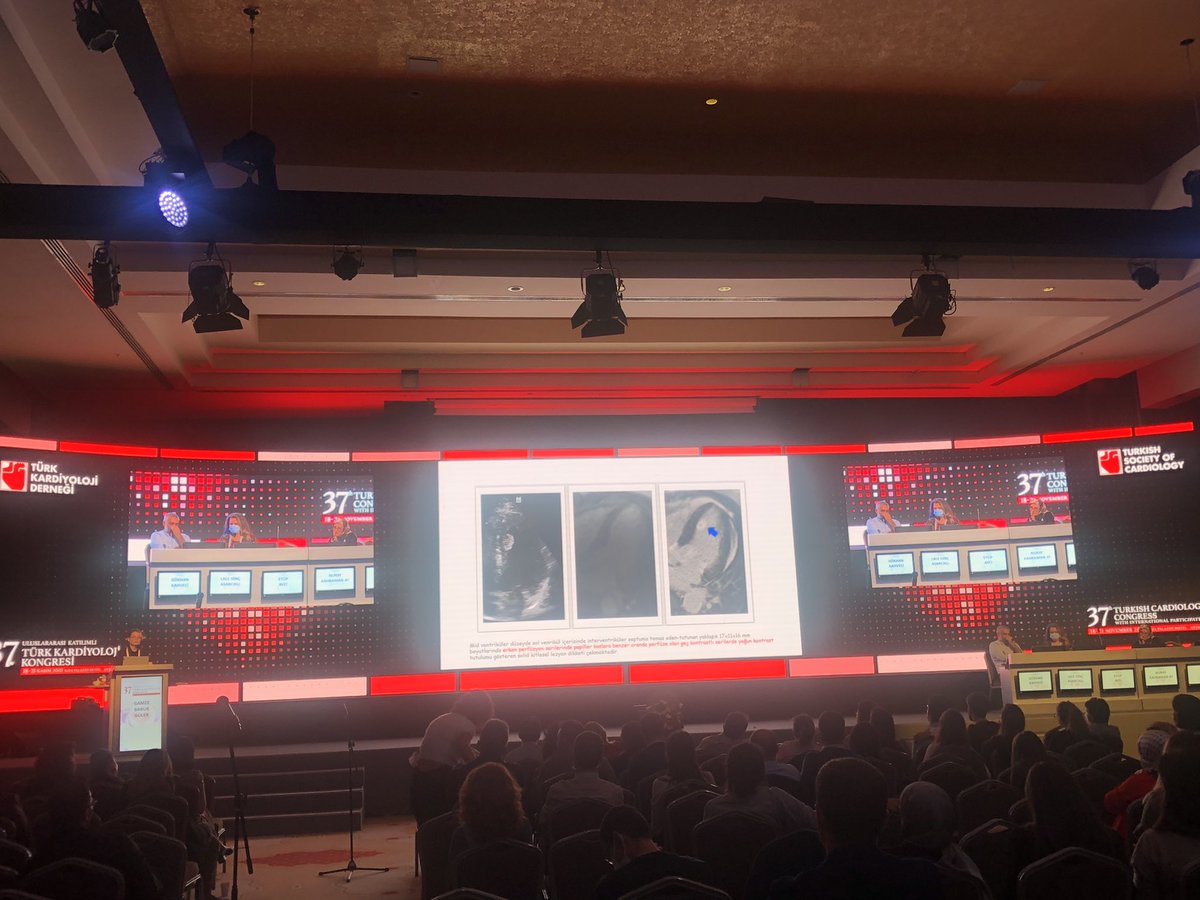 MDuyguinan's tweet photo. Thanks @gamzebaburguler and @kahvecimd for excellant cases and sharing their experiences ❤️❤️## Wonderfull session ## 37th TSC congress @TKDsosyal @AgcaFahriye @uygurbegum_ @cagdastpl @ismailblbn @emirdervis_ @karadumanmd @Songlstnda1 @benayozbay @RasihSonsoz @mdlaledinc https://t.co/tDPkOUTtJy