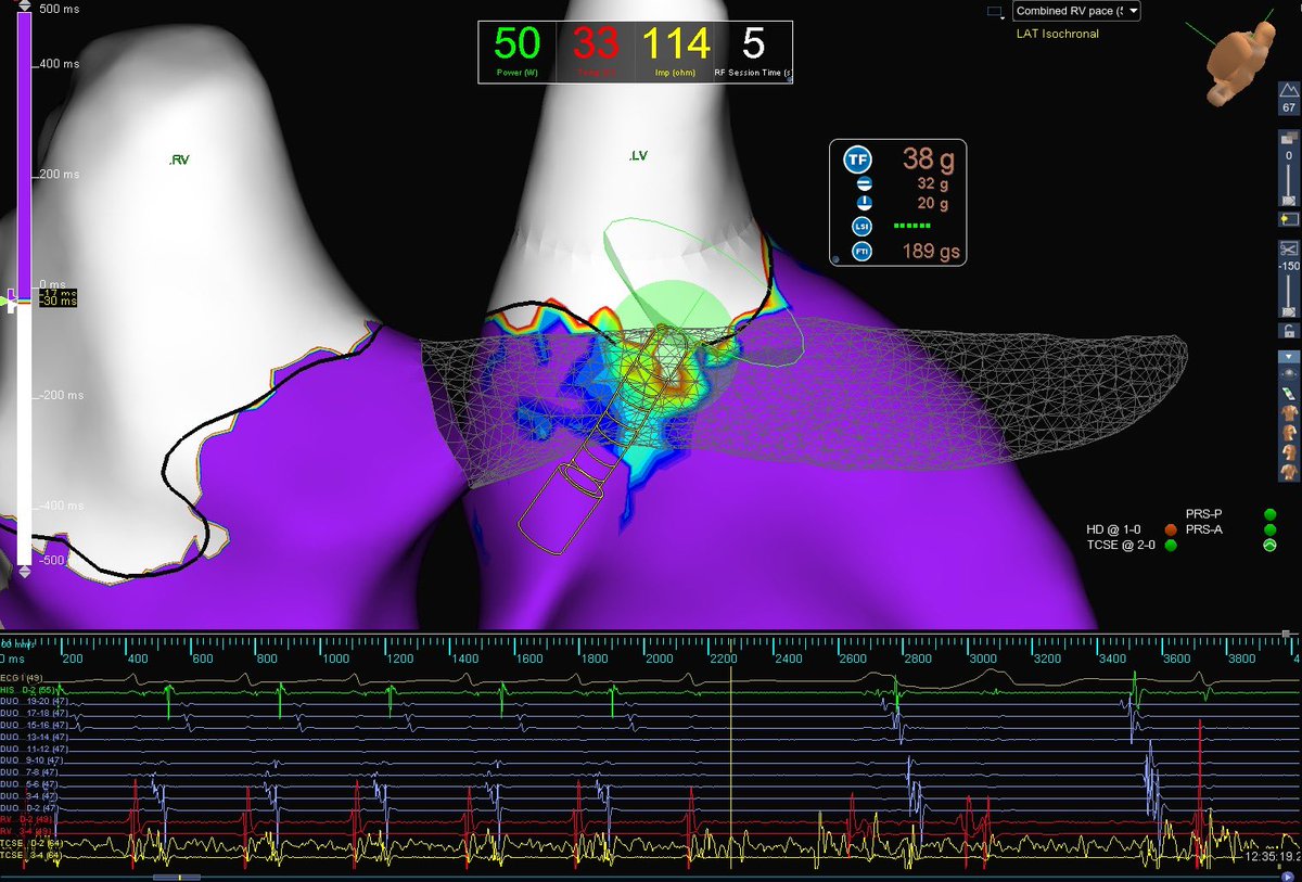 Adam Racette tweet media