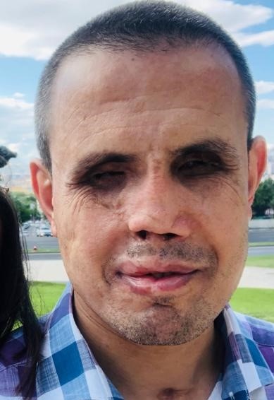 sevincozarslan's tweet photo. 10 aydır tutuklu olan KHK'lı Bilal Konakçı'nın hali: 

1- İzmir Aliağa İlçe Emniyet Müdürlüğü’nde bomba imha uzmanı olarak görev yaparken 5 Şubat 2009’da elinde bomba patlayan Bilal Konakçı’ya Ege Üniversitesi Tıp Fak. % 98 engelli raporu verdi.

GaziBilalKonakçıya Tahliye https://t.co/GbLh1NhtVS