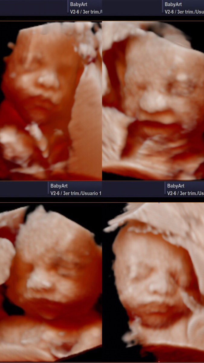MalusSchust's tweet photo. Me cuesta creer que este bebé hermoso está en mi panza❤️ te esperamos brunito, falta menos 👶🏻✨🐣❣️ https://t.co/PJKru8yShN