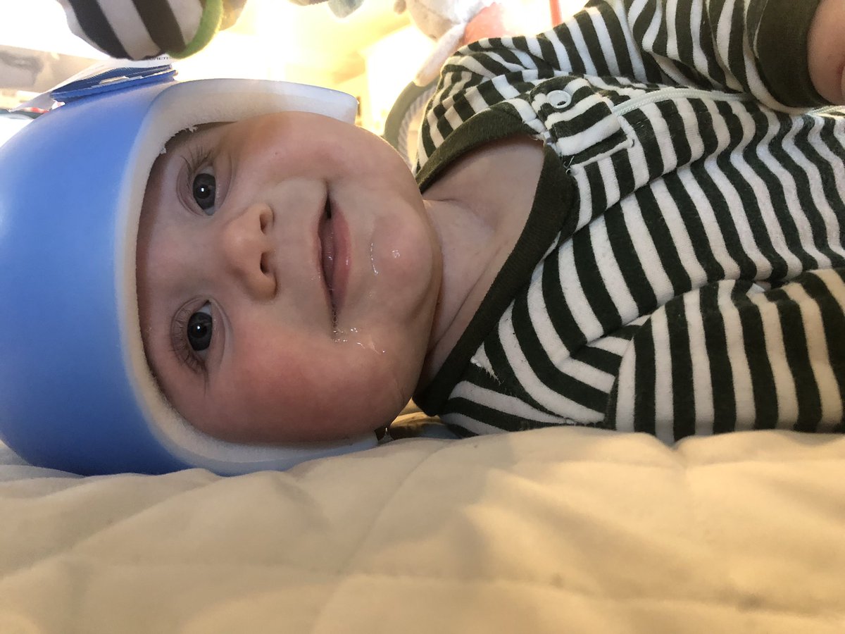 anniem0214's tweet photo. Just when I thought my baby couldn’t possibly get any cuter, he got a helmet. #thosecheeks https://t.co/KMP8kKUkuf