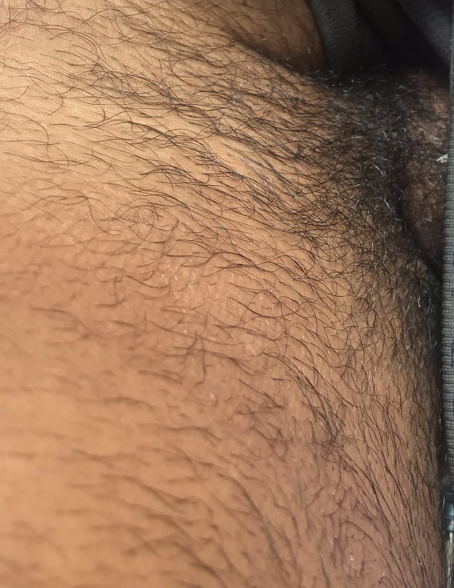 magrelogyn1's tweet photo. Não sei se rapo ou deixo crescer mais?🤔 https://t.co/7p2C4Wx5Au