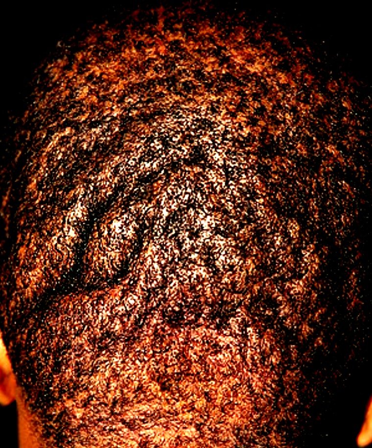 JmieTee's tweet photo. Hookworms, threadworms, deer fly worms, roundworms etc. Penetrate our pores/skin and live there for years &amp; reproduce by the thousands. What makes us think it won't penetrate our faces &amp; scalps &amp; hide under our hair &amp; suck blood &amp; oxygen from our heads? https://t.co/1am2PV5ztN