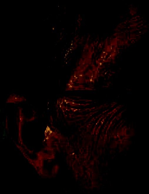 JmieTee's tweet photo. We can eat dwarf tapeworms that go through our intestinal wall (only 1-5mm)  &amp; enter our bloodstream. From there they can travel to our muscles, eyes, brain. Lumps can look like whiteheads, pimples, wrinkles. This can secretly be causing mental/neurological issues. @MindfulNeuro https://t.co/03PsbhXKGh