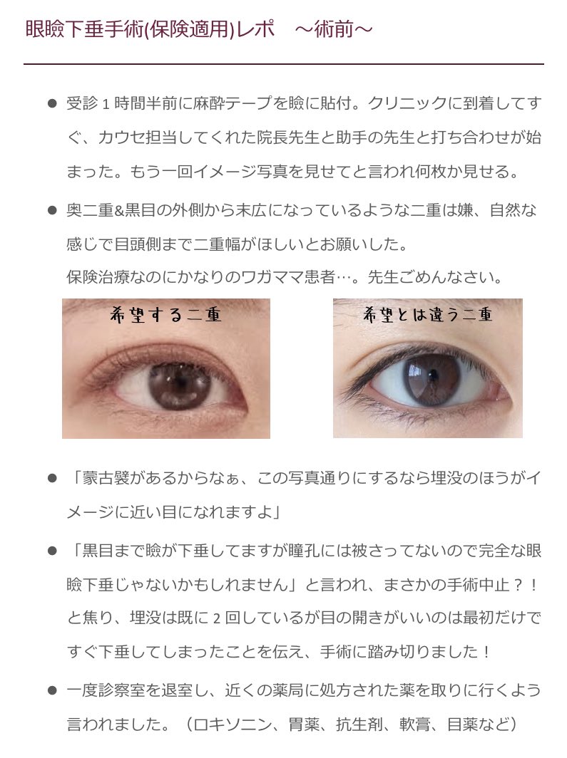 ZXk3l's tweet photo. 保険適用の眼瞼下垂手術レポ(術前〜術中〜術後)
文字が細かくて見にくいかもしれないですごめんなさい🥲
#眼瞼下垂　#眼瞼下垂DT https://t.co/MDjWjCuPwf