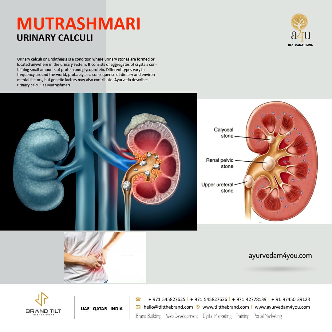 Ayurveda in UAE, mutrashmari – urinary calculi causes, symptoms, treatments in Ayurveda?
ayurvedam4you.com/india/mutrashm…
👉Our mail id: mail@ayurvedam4you.com
👉Contact us +971 545827626, +91 9745039123 
#urinarycalculi #ayurveda #uae #india #dubai #KidneyDisease #kidneystone #ayurvedic