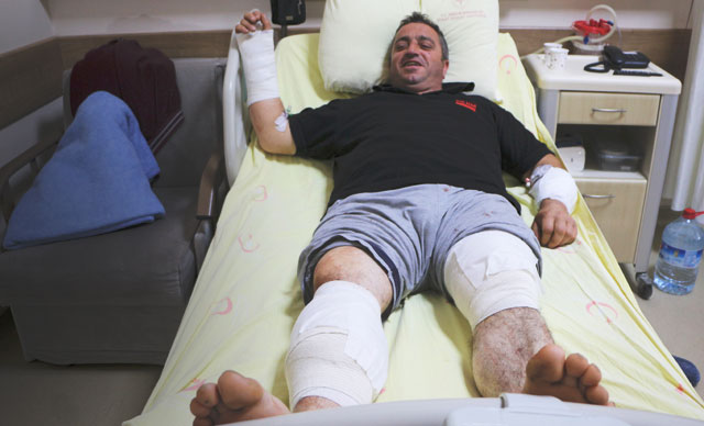 Ayı saldırısından güreşerek kurtuldu: Beni bu hale getirdi ama bir de siz ayıyı görün. Ayı daha perişan
dha.com.tr/r/1861179