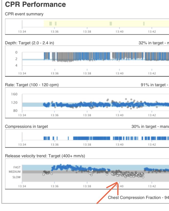 This is why we switch compressors.  Providers often don’t recognize when they start leaning in the chest.  Recoil matters.  #hpcpr <a href="/ArestCpr/">AREST Prehospital CPR</a>