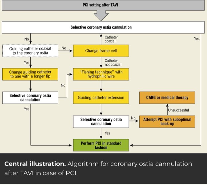 barbanti_marco's tweet photo. A practical guide for coronary artery cannulation and PCI after TAVI. Find out tips&amp;tricks in this comprehensive review article published in latest issue of @EuroInterventio https://t.co/Fmr0VUSKU4 @GilbertTangMD @TCTMD @PCRonline https://t.co/LtGP1YrcDQ
