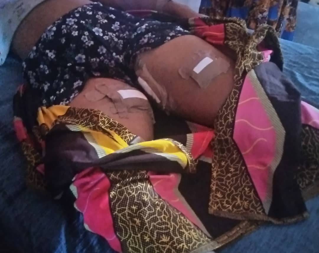 MaziKanuntaKanu's tweet photo. #Biafraland has turned  into a shooting range for the #Jihadist recruited back into #NigerianSecurityStructure. Meanwhile #DSS brutality continues across #Biafraland,as they shot #MissChinemeremOgoke from Obowo in Imo state in both legs and she was left to drown in her own blood. https://t.co/WvIaQgjinu