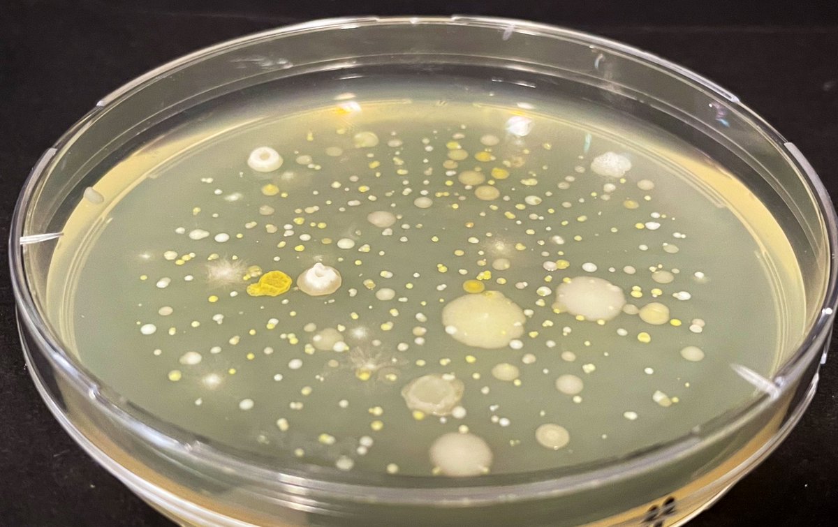 biofilmMan's tweet photo. #bacterial constellation ✨✨✨✨✨✨✨✨✨✨✨✨✨✨✨✨✨✨✨✨✨✨✨✨✨✨✨✨✨✨✨✨✨✨✨✨✨✨✨✨✨✨#aeromicrobiology #bacteria #air #microbiome #MAS100 #MicrobialAirMonitoringSystem @MMilliporePS https://t.co/8t8z1Tadhr