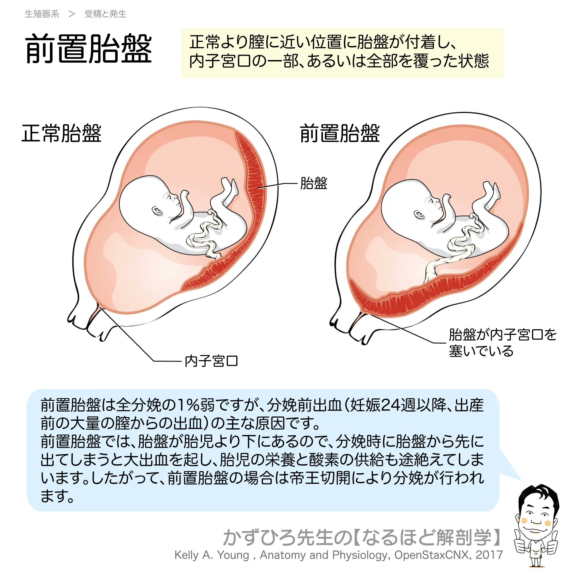 子宮口 