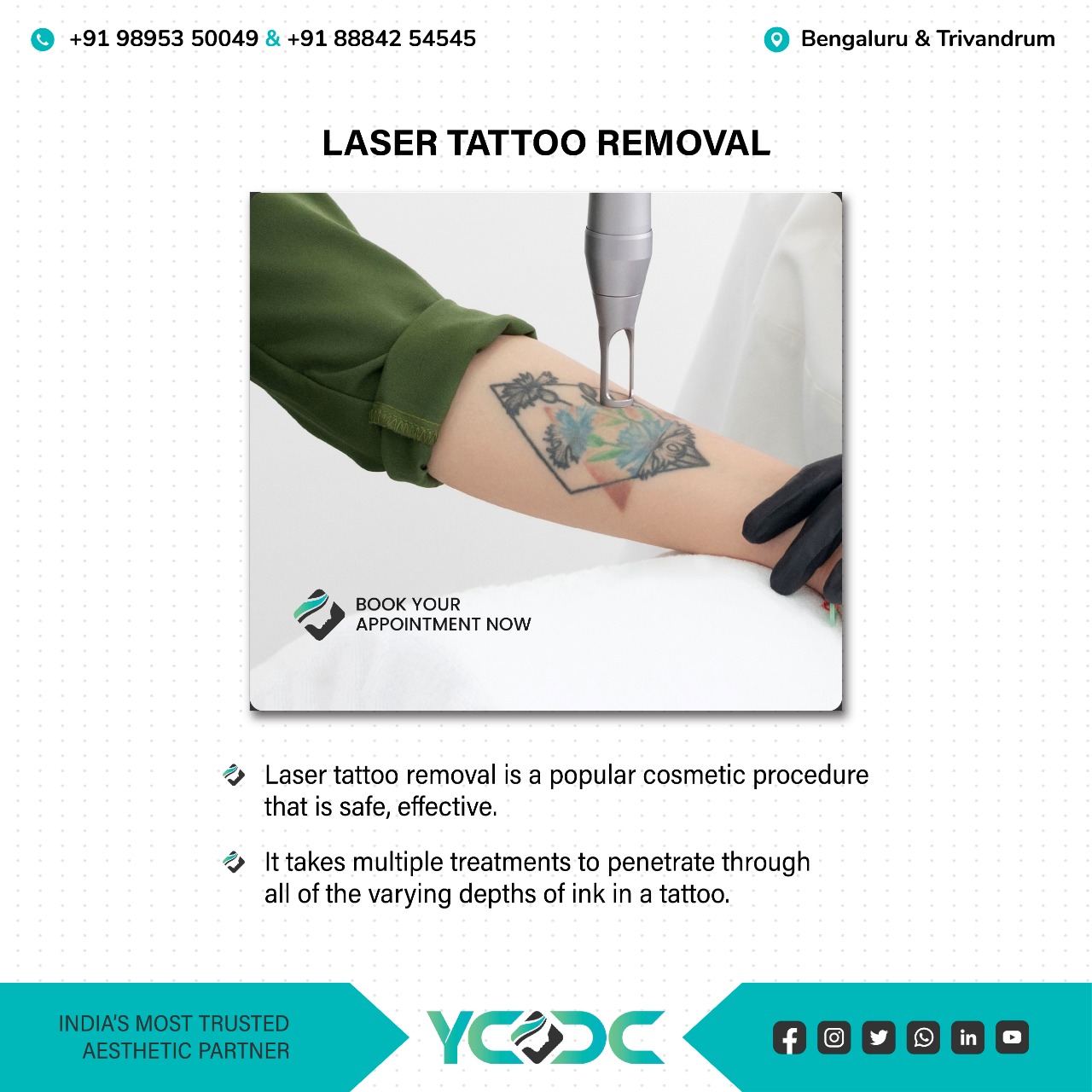 Laser Tattoo Removal Treatment in India