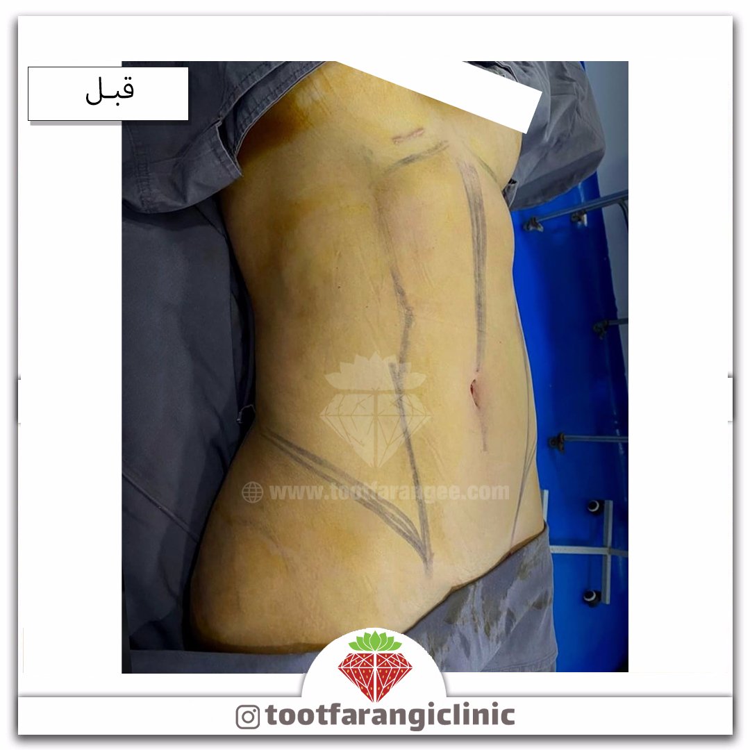 Tootclinic's tweet photo. #ویزر https://t.co/k45TatQI22