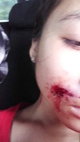 karen_kecd's tweet photo. 2 students ages 14+16 from Baw Th'Roo village have been shot by BGF during its attack on KNU's Pwa Gaw clinic, 1st Bgde this week. They were on their way home from a short school break. They study at Mae Theh Khee high school at Grades 8 and 10. At least 1 of them needs surgery. https://t.co/6lfrLv95am