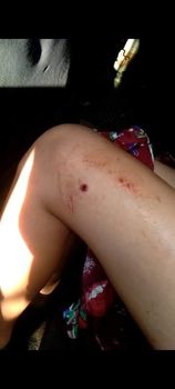 karen_kecd's tweet photo. 2 students ages 14+16 from Baw Th'Roo village have been shot by BGF during its attack on KNU's Pwa Gaw clinic, 1st Bgde this week. They were on their way home from a short school break. They study at Mae Theh Khee high school at Grades 8 and 10. At least 1 of them needs surgery. https://t.co/6lfrLv95am