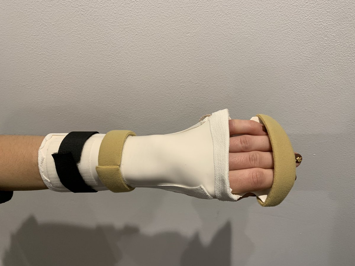 The__Hough's tweet photo. Got to make my first ever hand splint on placement this week. Thank you to my amazing educator for teaching me 💚 @LincsCTherapy https://t.co/g2jPCHIaf4