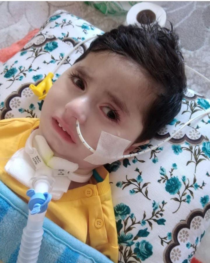 Bugün #DünyaCocukHaklarıGunu ama
Sma hastası çocuklarımız cihaz olmadan Nefes dahi almıyor.
ZolgenSma tedavisi hakkını kaybetmemek için kilo kriterine takılmasın diye her akşam aç yatırılıyorlar

Sma hastası çocuklarımızdan  #AbdullahaNefesOl ki
Abdullah Yaşasın

<a href="/Abdullaha_nefes/">Abdullah SMA TİP1 (Valilik izinli kampanya)</a>