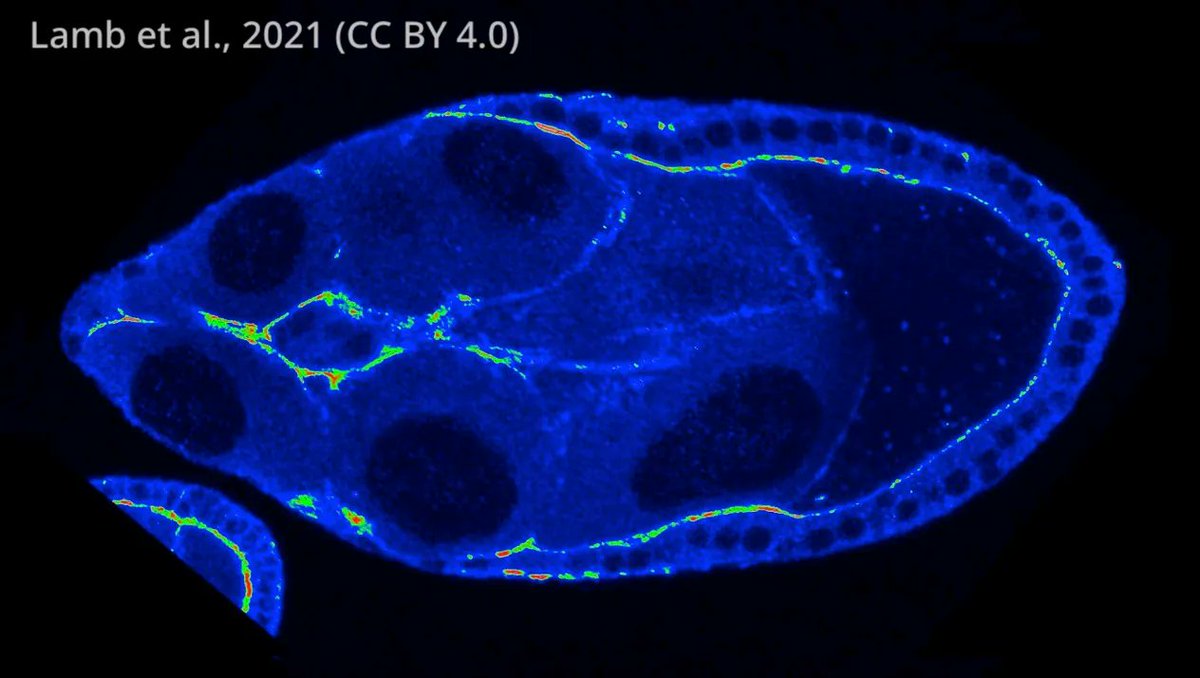 Cells can control their ability to move through the body by using a protein called fascin to control the stiffness of neighbouring cells elifesciences.org/articles/69836…
