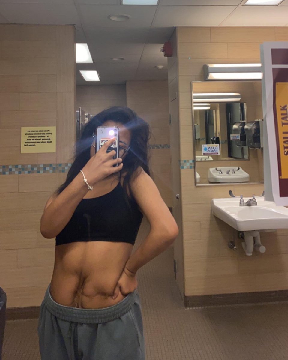 skiinywh0re's tweet photo. TW BODY CHECK mono n alcohol 131.6 ahhhh https://t.co/7FnbcLXDI5