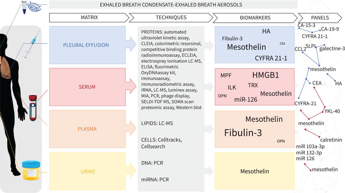 ERSpublications's tweet photo. Diagnostic biomarkers for malignant pleural mesothelioma seem promising; however, further research is necessary to prove their clinical value. This review provides a thorough overview of the different markers and compares them in several matrices. https://t.co/wadU3bdlUy https://t.co/BGsJ4jrIC8