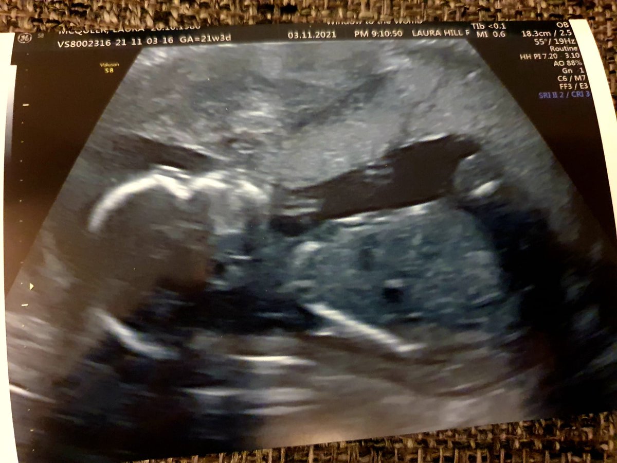 McD20380's tweet photo. After weeks of trying to keep quiet I can now happily announce we are due another wee bear in April 💙👶 https://t.co/n9isiJfLrD