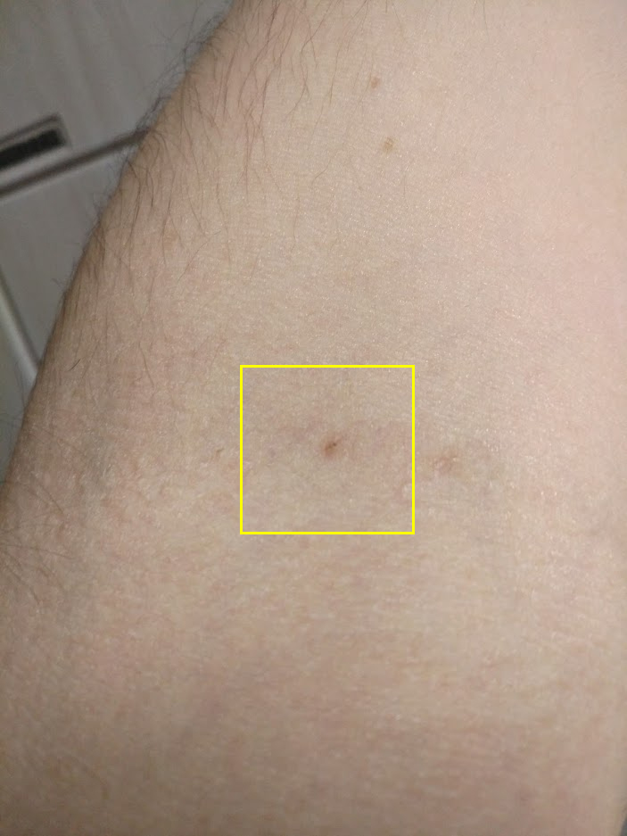 PerOmerDil's tweet photo. A little needle mark and some pain was totally worth it to get protected from Covid. #서울글로벌센터이벤트 #외국인선제검사 #외국인백신접종 @seoulglobalcenter https://t.co/uMSyg4VZbC