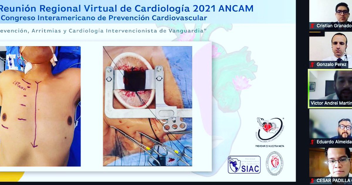 ‼️Felicidades a los Ganadores‼️
#Jóvenes #Cardiólogos y Cirujanos Cardiovasculares, compartiendo.  Grandes Premios respaldados por ambas sociedades <a href="/ANCAM_MEXICO/">ANCAM México</a> <a href="/SIAC_cardio/">SIAC</a> incentivando la producción científica!! 👏🏼