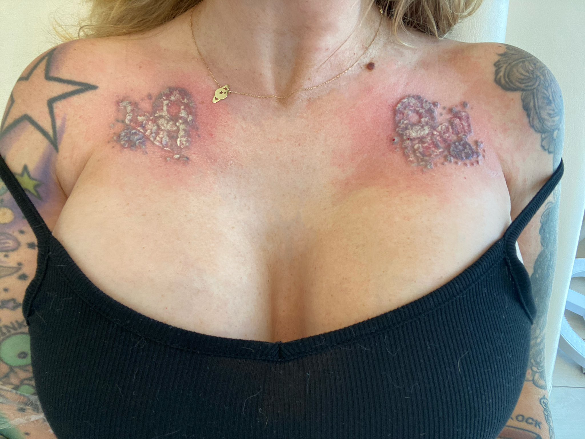 Laura Lux 🦖🪐 on X: posted a lil tattoo removal video to tiktok if youre  interested in watching ⚡️ t.coc9uzDPc2AL t.cowd3MTiz2ha   X